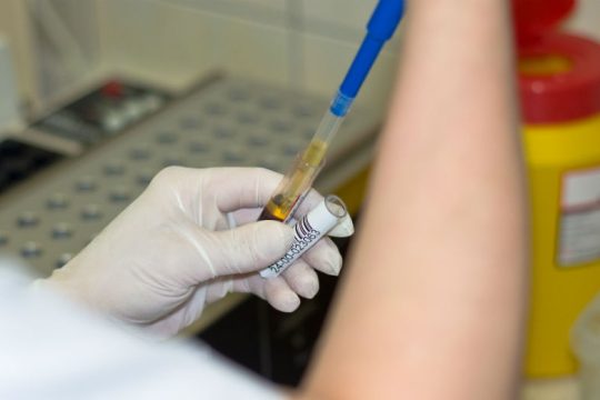 Τεστ αίματος για τον καρκίνο του στήθους από Γερμανούς επιστήμονες